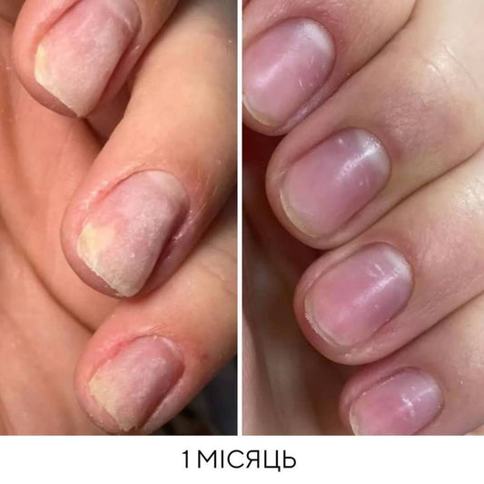 NAILSOFTHEDAY ONISTOP – a regenerating oil against onycholysis, 15 ml