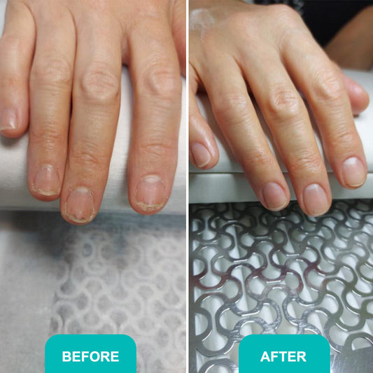 OIL FOR DAMAGED NAIL PLATE  Comprehensive care for damaged and healthy nails 30 ml