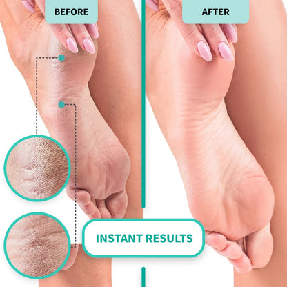 SPA BATH FOR MANICURE AND PEDICURE  Professional spa bath for softening and preparing hands and feet 500 ml